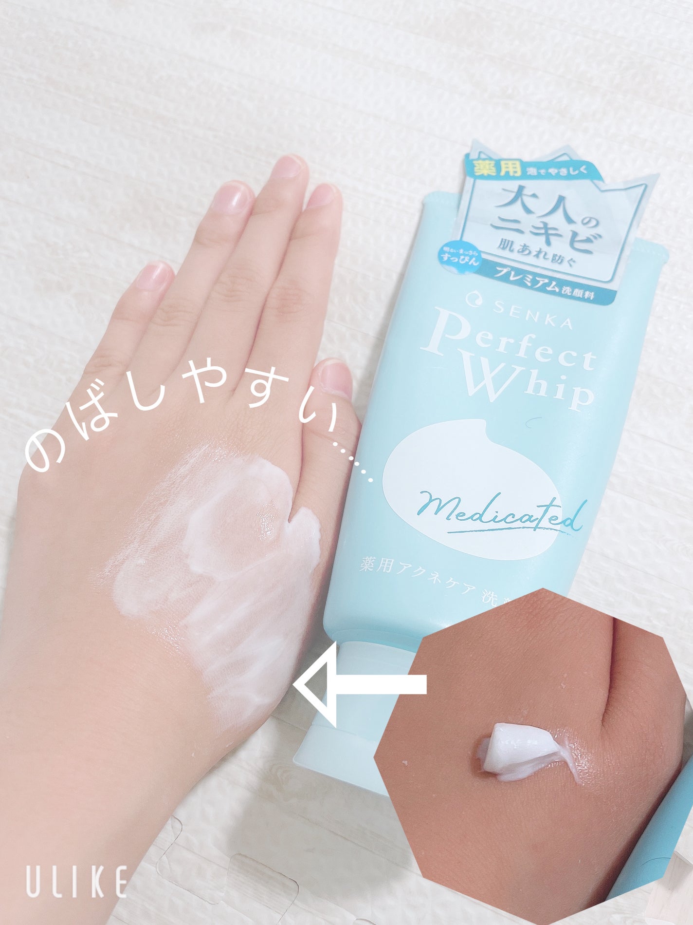 パーフェクトホイップ アクネケア/SENKA(専科)/洗顔フォームを使ったクチコミ(3枚目)
