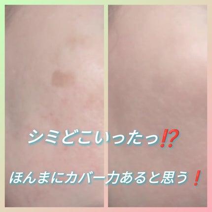 タトゥーウォータープルーフスカーコンシーラー/フォレンコス/リキッドコンシーラーを使ったクチコミ(2枚目)