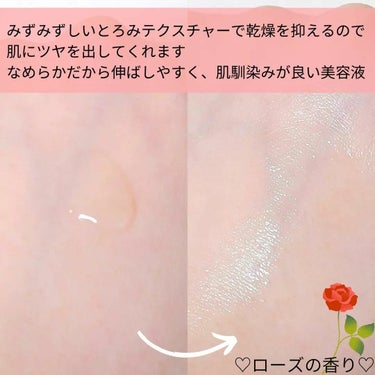 XOUL CLセラムのクチコミ「「XOUL（ソウル）CLセラム」をご紹介します🌟

🌸内容量:30ml
🌸価格:9800円

.....」（3枚目）