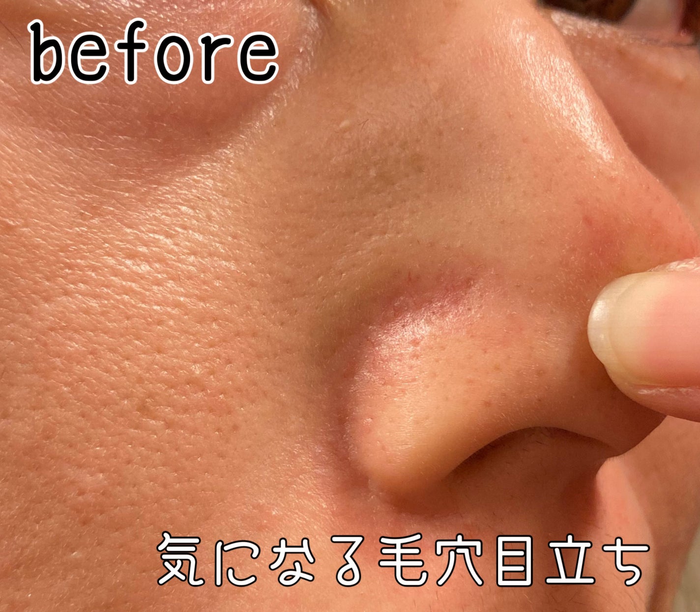 CICA デイリースージングマスク/VT/シートマスク・パックを使ったクチコミ(2枚目)