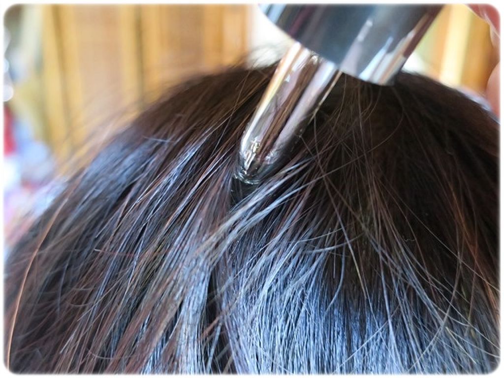 スカルプケアエッセンス/LINNA/頭皮ローションを使ったクチコミ（1枚目）