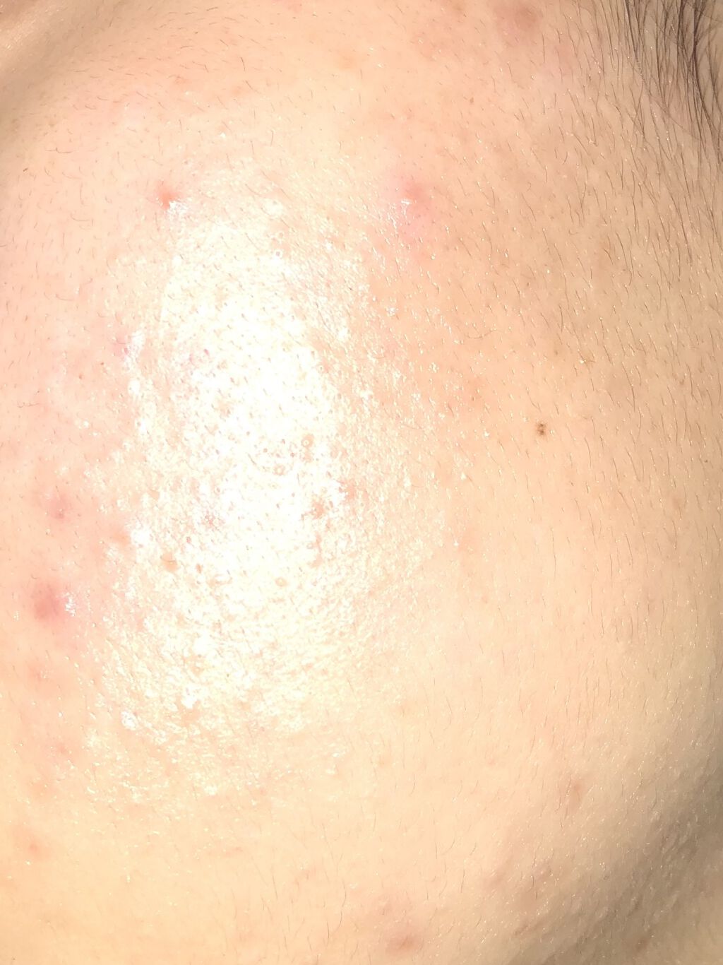 どくだみ化粧水(ナチュラルスキンローション)/CHINOSHIO/化粧水を使ったクチコミ（3枚目）