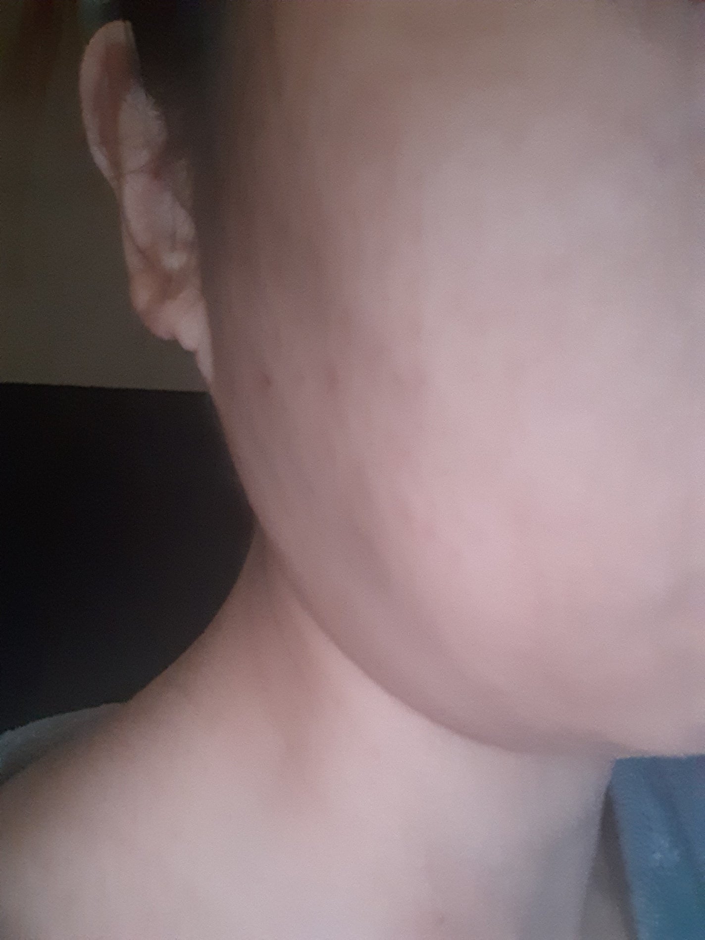 リードルショット リフティングセラム/VT/美容液を使ったクチコミ(2枚目)