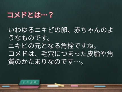 ソフティモ ディープ クレンジングオイル/ソフティモ/オイルクレンジングを使ったクチコミ(2枚目)