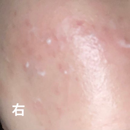 潤浸保湿 フェイスクリーム/キュレル/フェイスクリームを使ったクチコミ(2枚目)