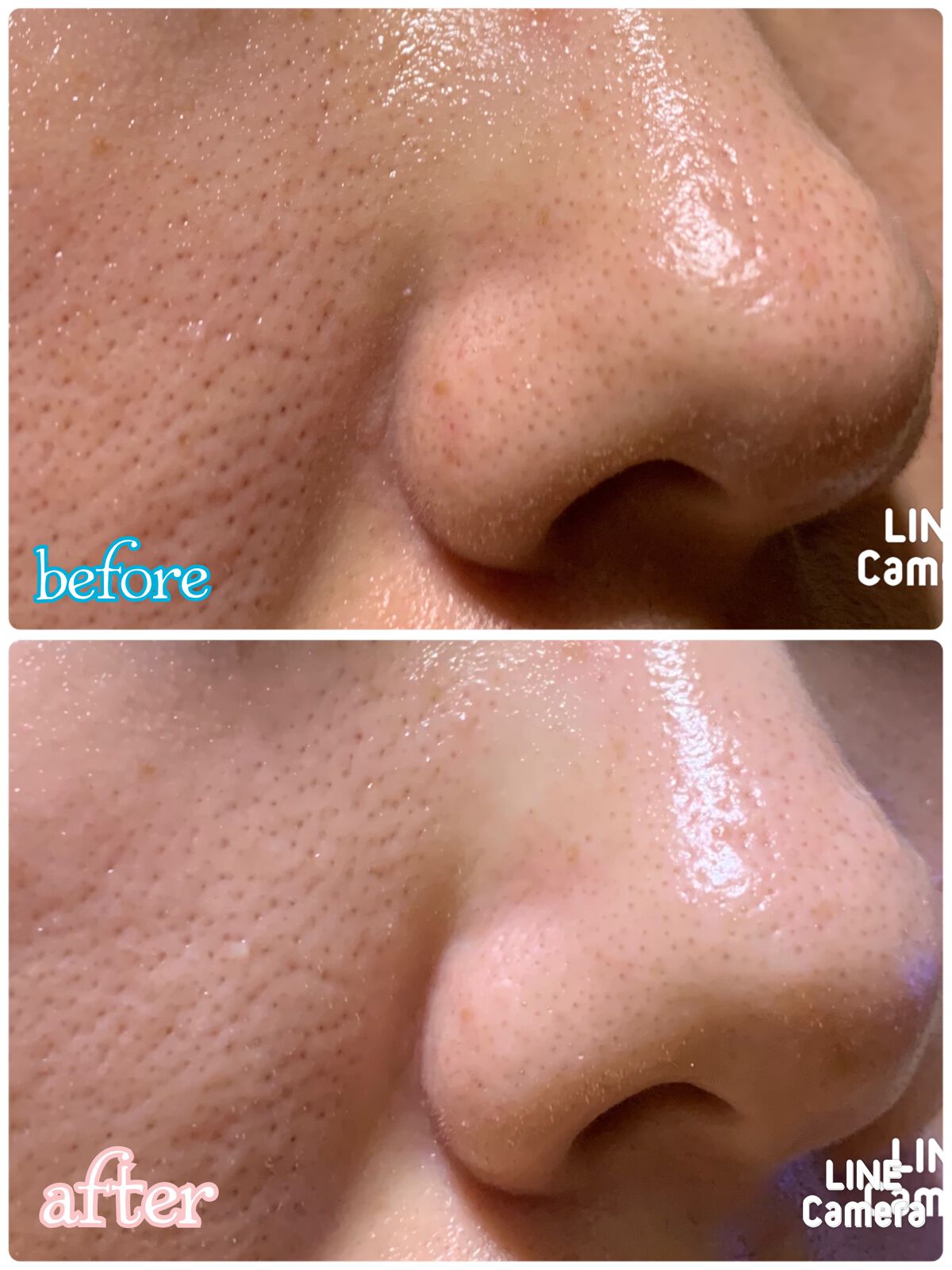 白潤プレミアム 薬用ジュレ状美白美容液/肌ラボ/美容液を使ったクチコミ（2枚目）