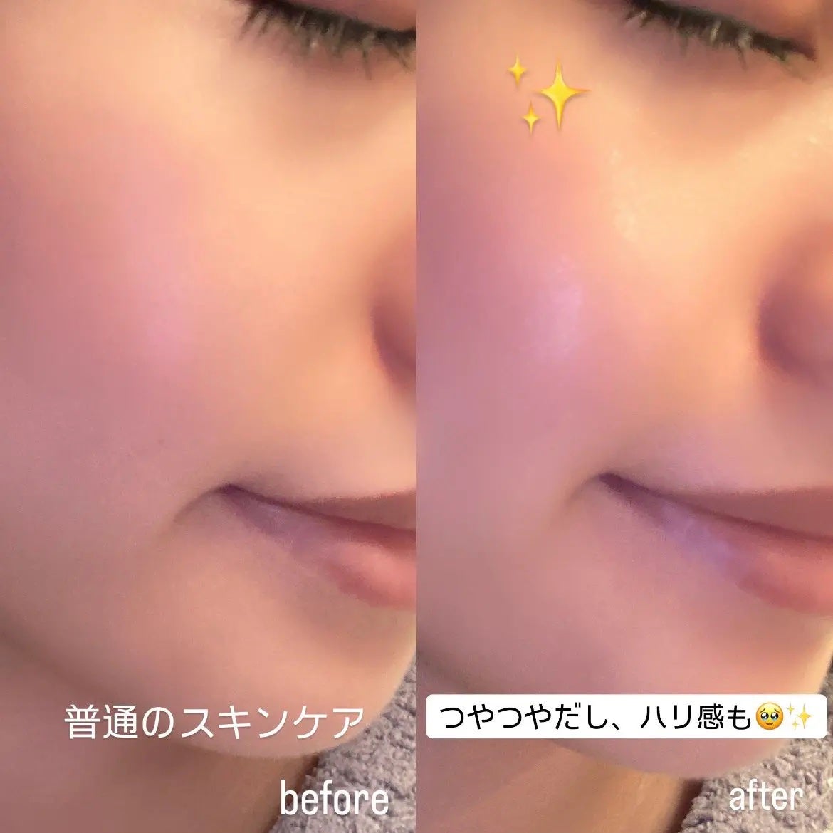 キャラメル美容さん on LIPS 「@medicube_japanの塗るサーモン注射がよかったので..」(2枚目)