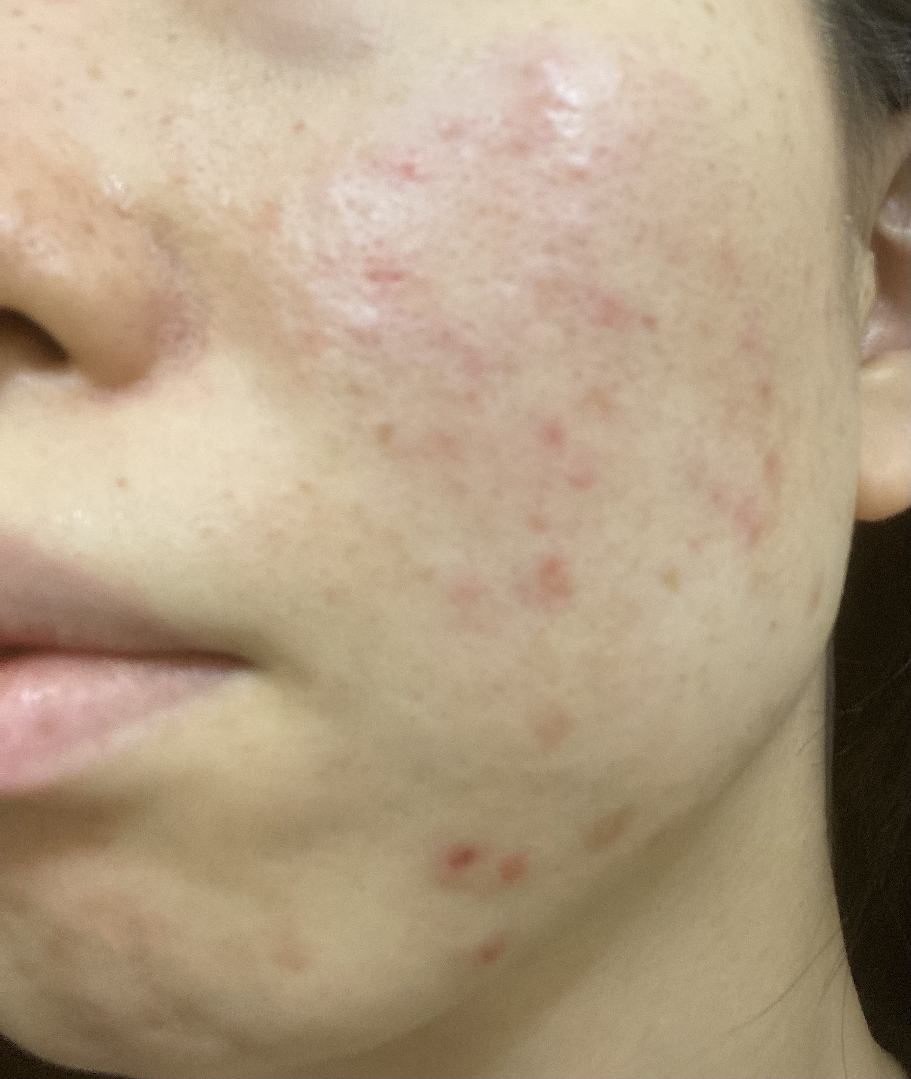 ザ・タイムR アクア/IPSA/化粧水を使ったクチコミ（3枚目）