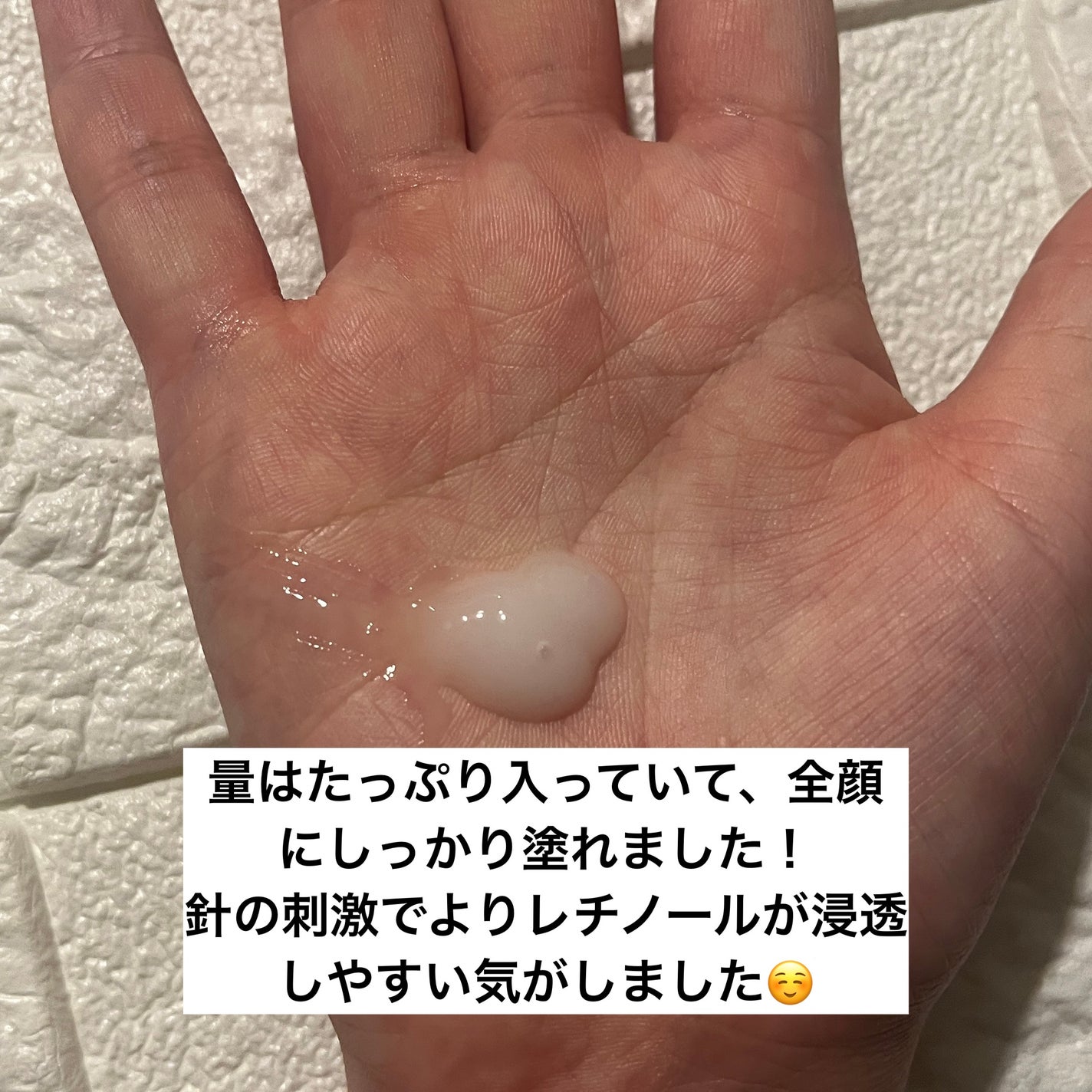 S100 レチAリードル/VT/美容液を使ったクチコミ(3枚目)