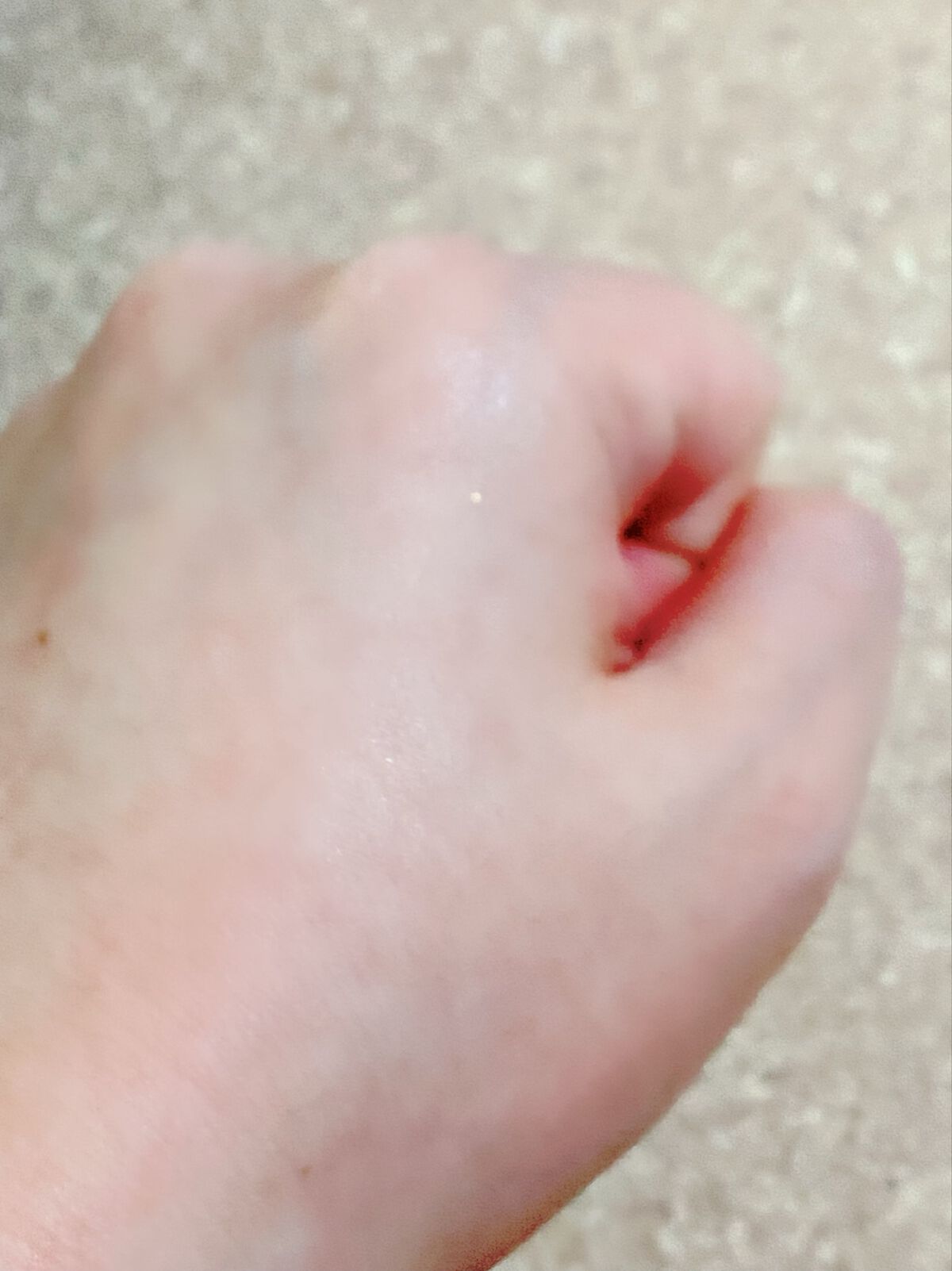 オードムーゲ 薬用ローション(ふきとり化粧水)/オードムーゲ/拭き取り化粧水を使ったクチコミ(3枚目)