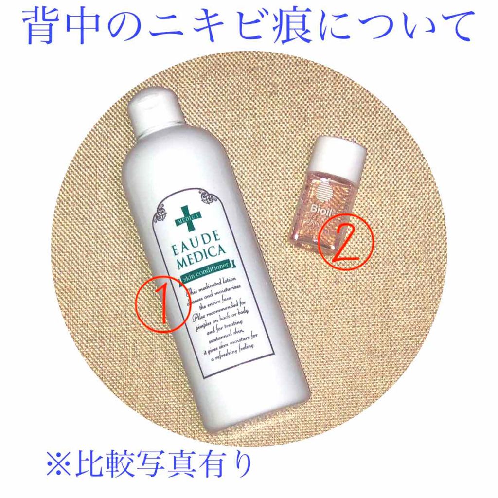 薬用スキンコンディショナー/オードメディカ/ボディローションを使ったクチコミ（1枚目）