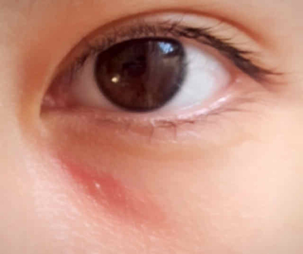 カバーパーフェクション チップコンシーラー/the SAEM/リキッドコンシーラーを使ったクチコミ（2枚目）