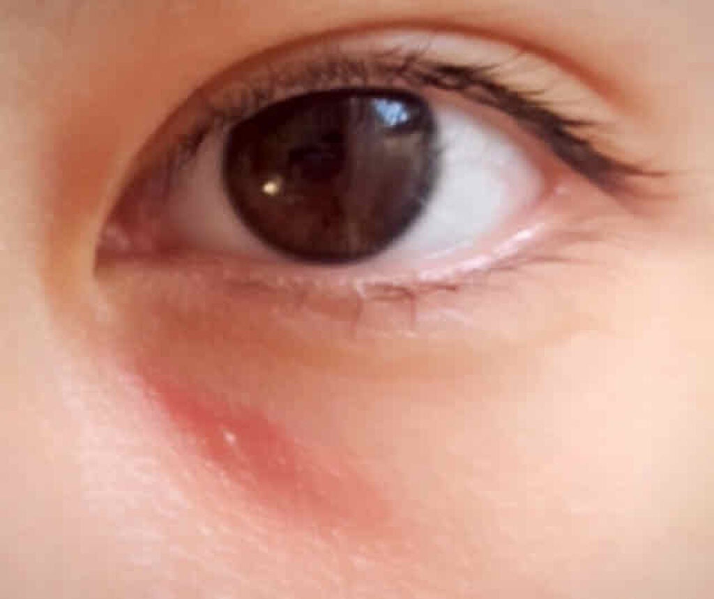 カバーパーフェクション チップコンシーラー/the SAEM/リキッドコンシーラーを使ったクチコミ(2枚目)