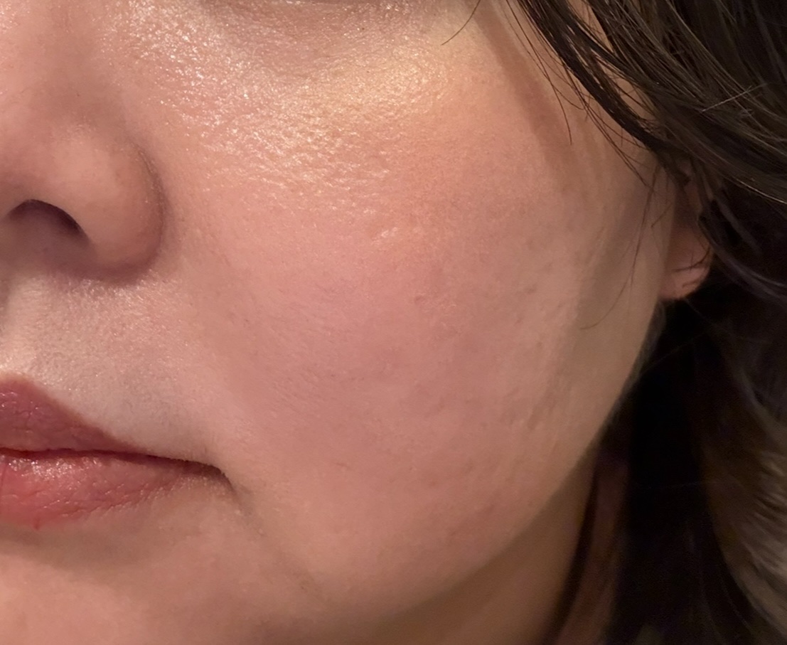 ゼン ウェア グロウ/DECORTÉ/リキッドファンデーションを使ったクチコミ（1枚目）