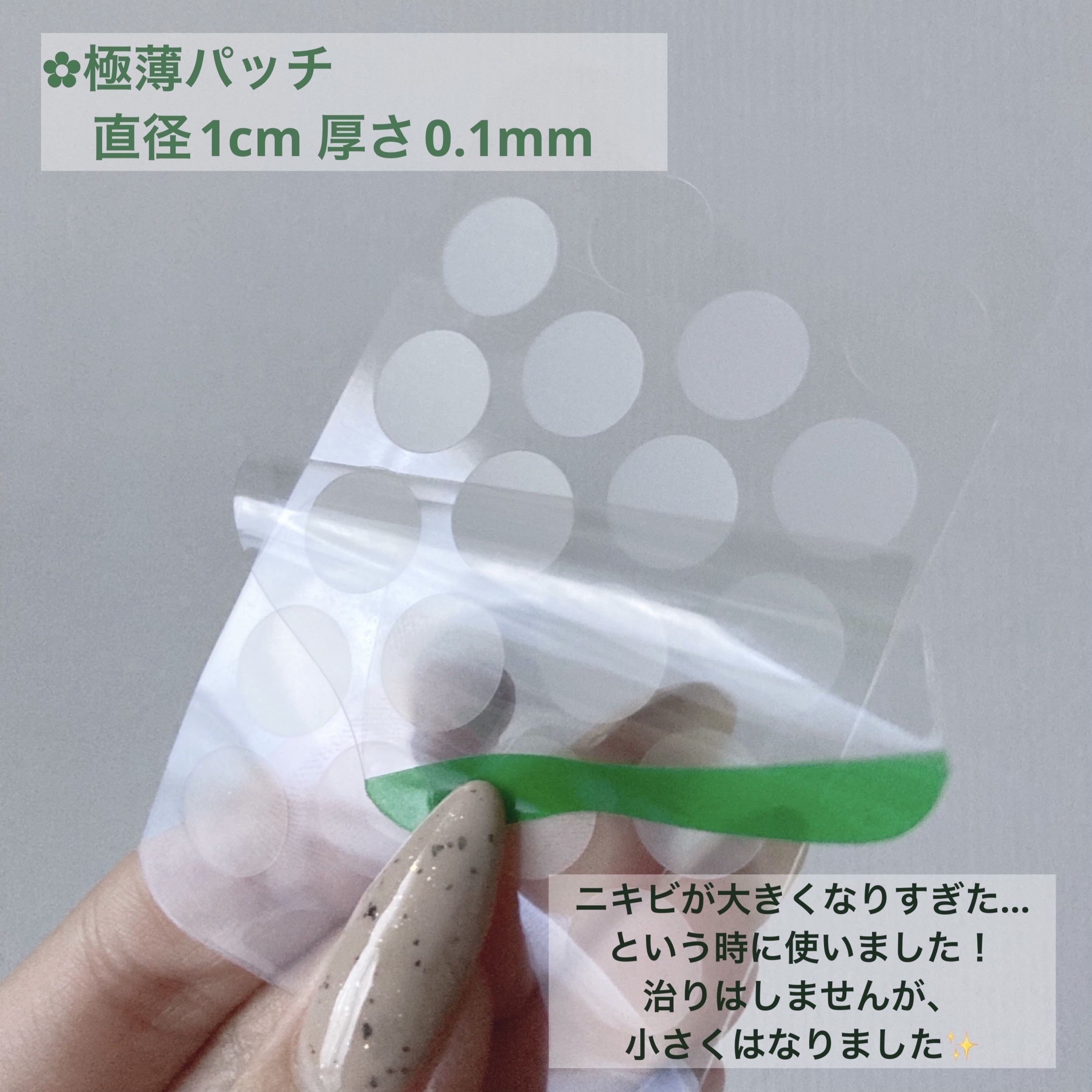 ACC パッチ/ETUDE/シートマスク・パックを使ったクチコミ（3枚目）