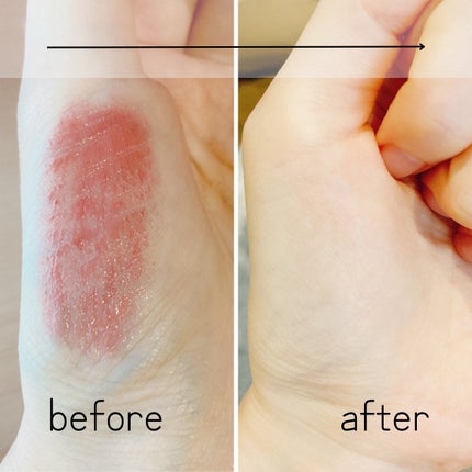 St-Care クレンジングオイルフォーム/orin/その他洗顔料を使ったクチコミ(4枚目)