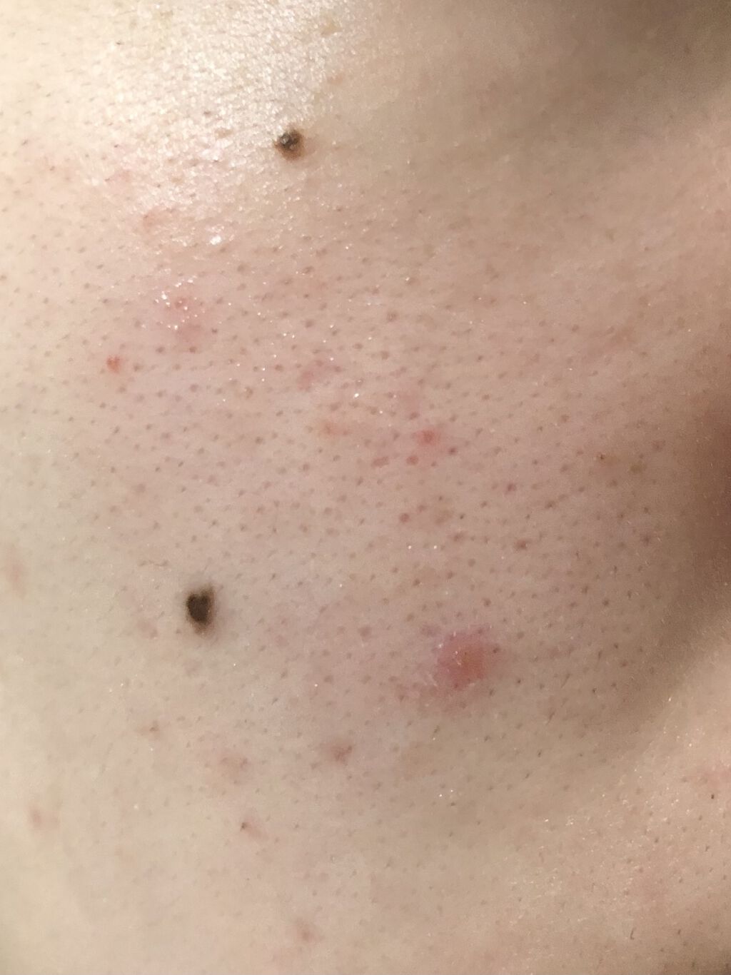 白色ワセリン(医薬品)/健栄製薬/その他を使ったクチコミ（3枚目）