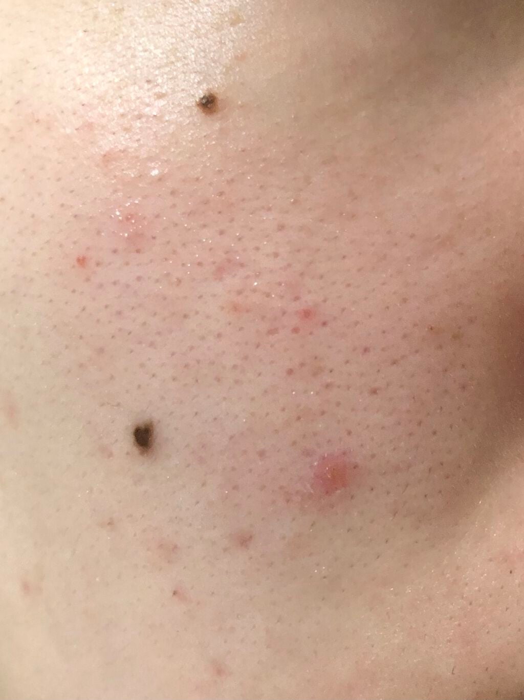 白色ワセリン(医薬品)/健栄製薬/その他を使ったクチコミ(3枚目)