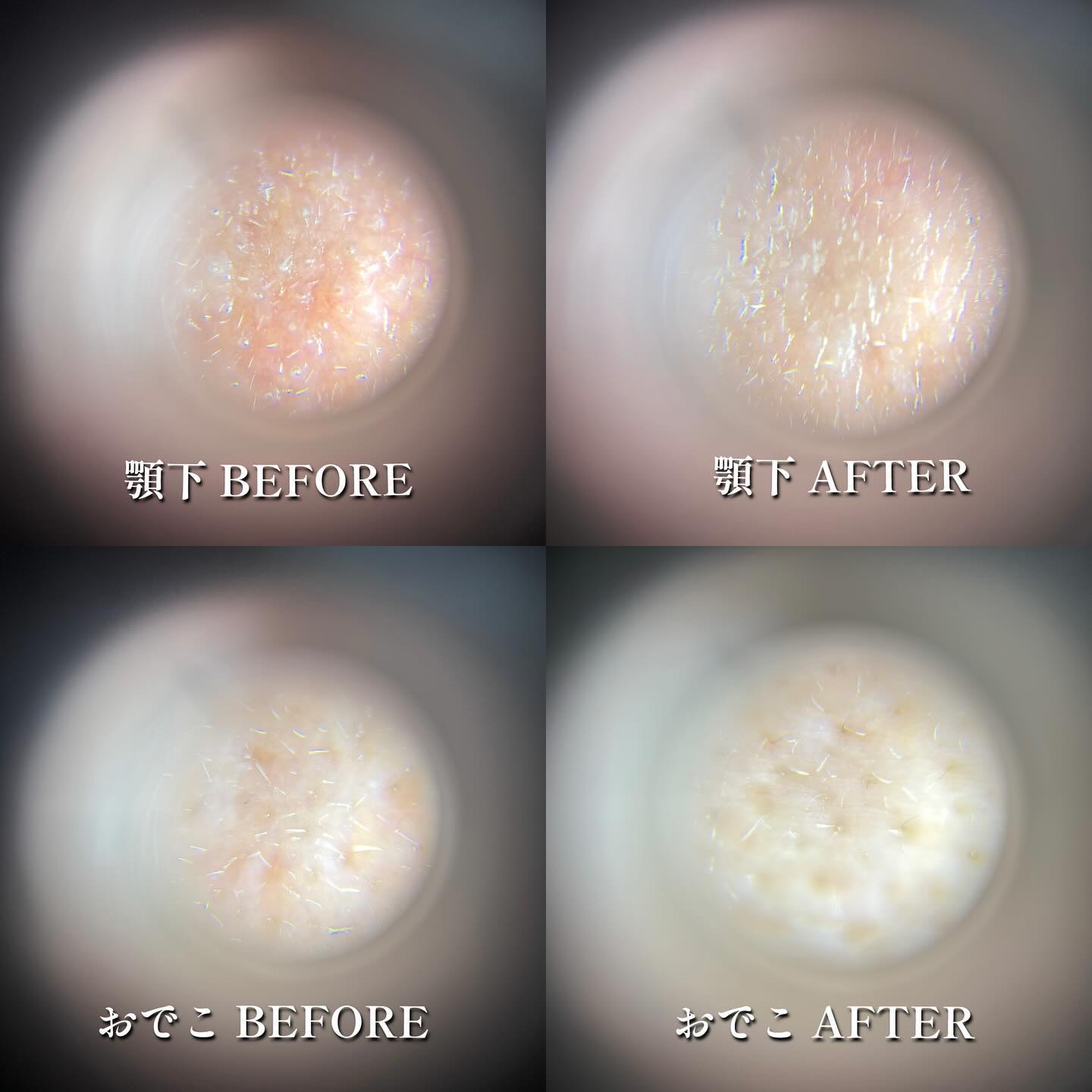 リードルショット300/VT/美容液を使ったクチコミ（2枚目）