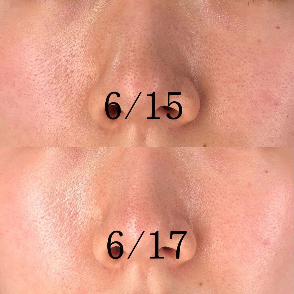 日焼け止めミルク/ママはぐ/日焼け止めミルクを使ったクチコミ（2枚目）