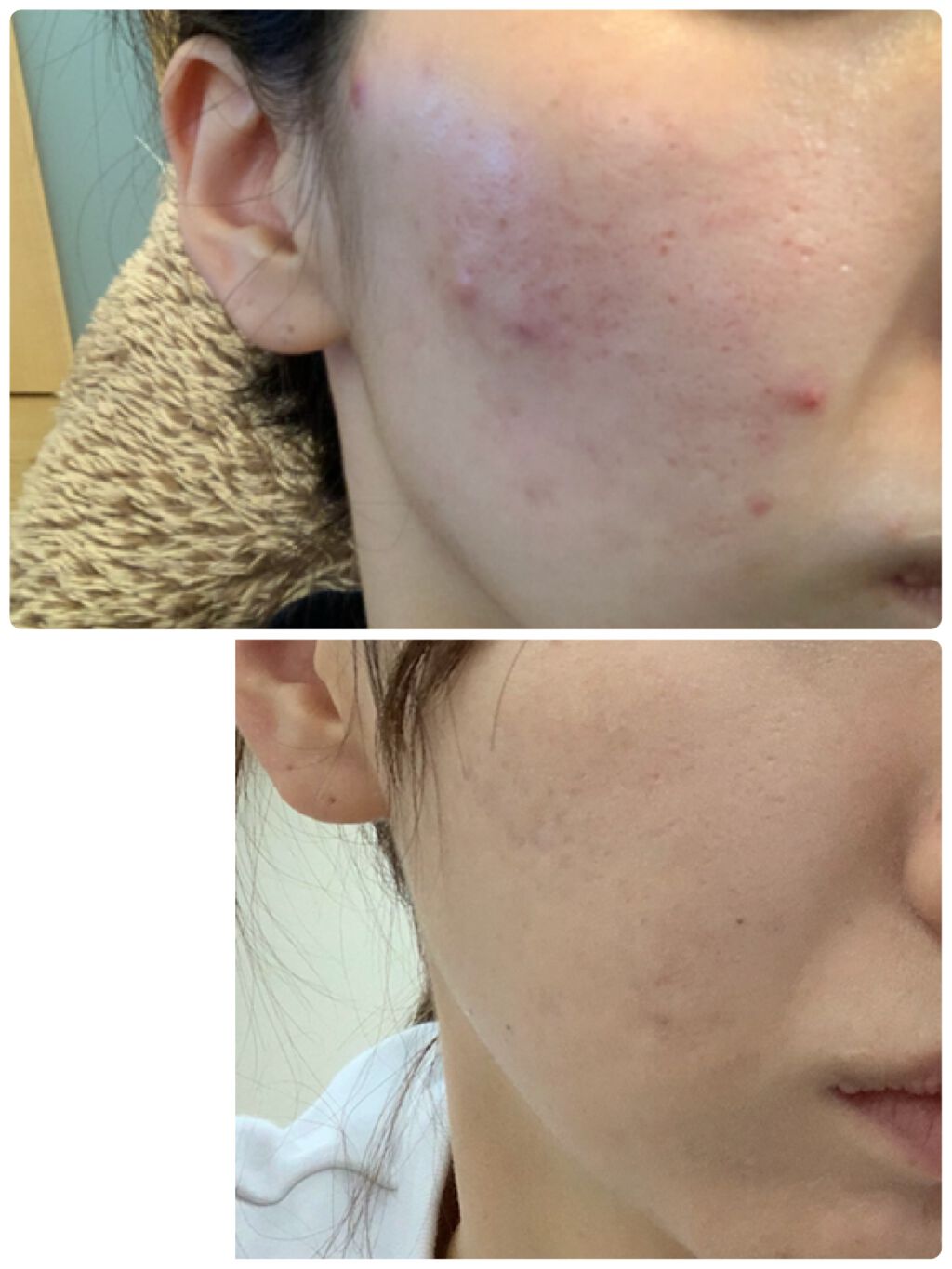 フェイシャル トリートメント エッセンス/SK-II/化粧水を使ったクチコミ（1枚目）