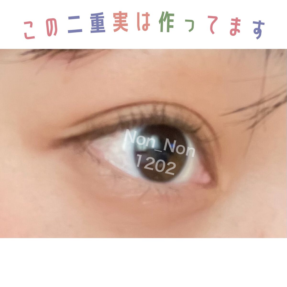 救急バン/L.mo/その他を使ったクチコミ（1枚目）