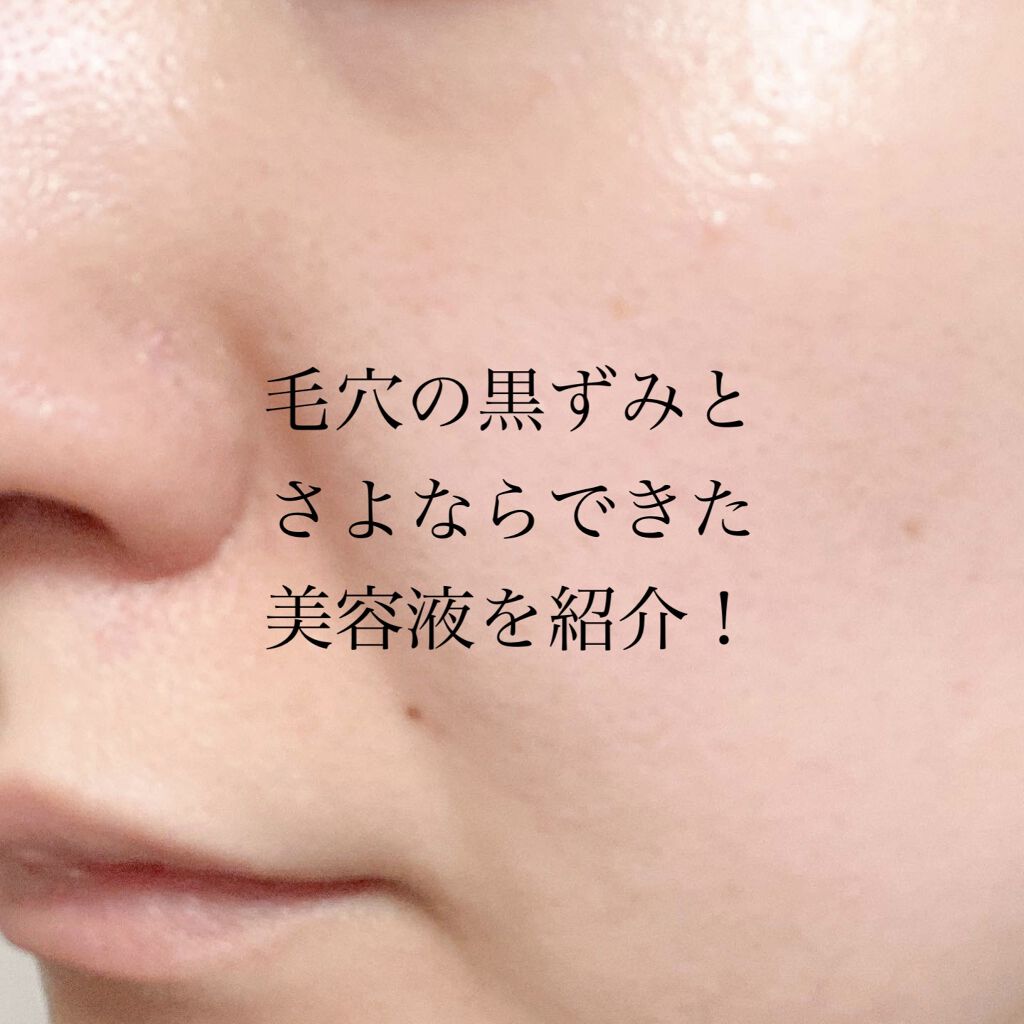 スーパー毛穴ピールセラム/ラボラボ/美容液を使ったクチコミ（1枚目）