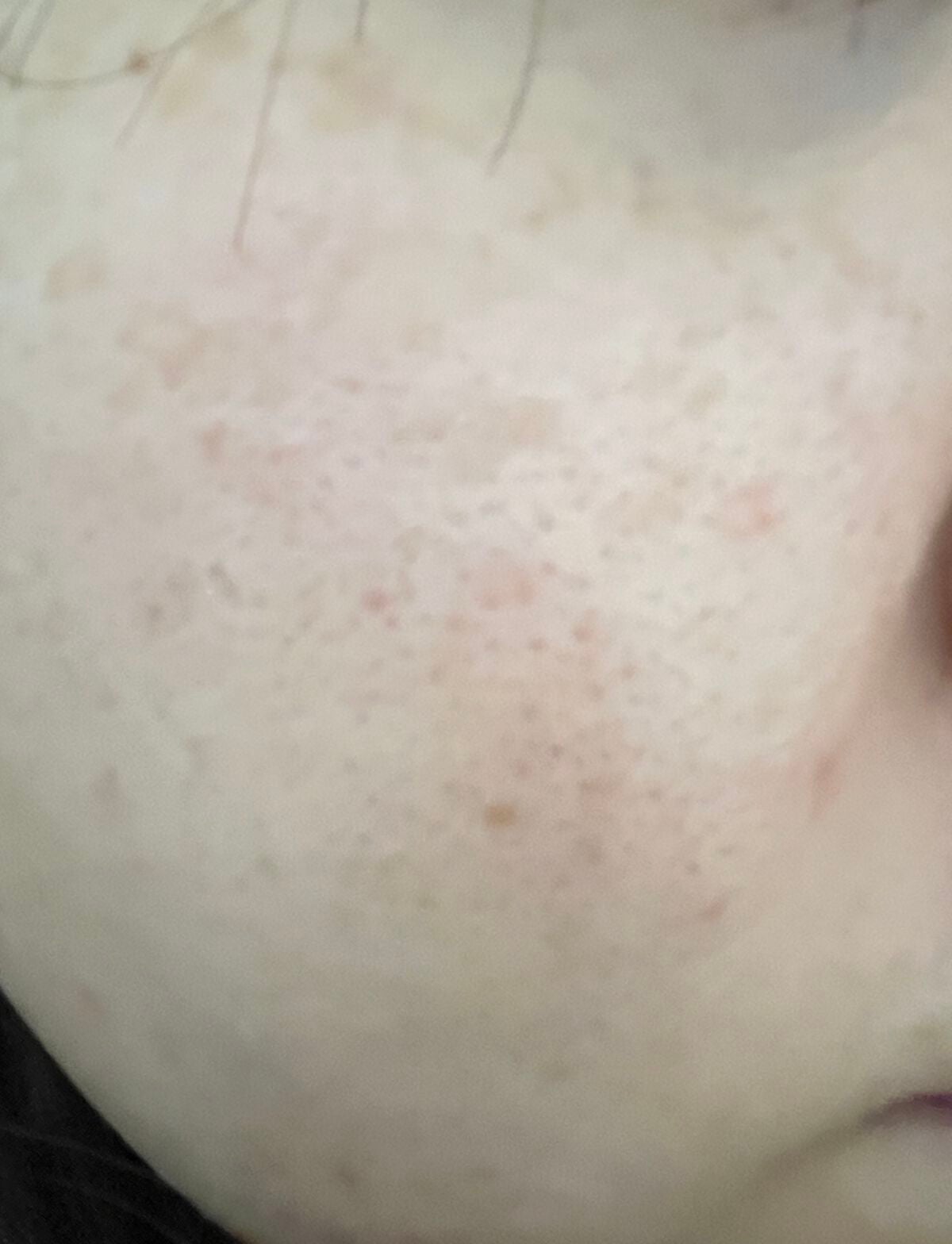 ユース ラディアンス ビタチノール セラム/primera/美容液を使ったクチコミ(5枚目)