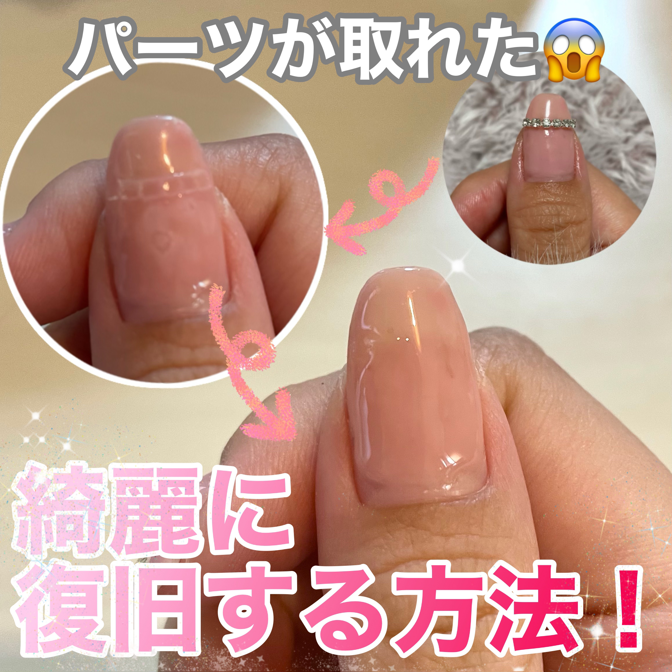 パーツが取れてしまったネイルの復旧方法！



先日塗り塗りしたこちらのネイル(https://lipscosme.com/posts/6895682?_t=zLqY&_r=vVpR67)

なんとパーツが取れてしまいました😱


という