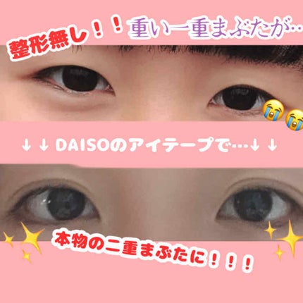 アイテープ 埋没式両面テープ/DAISO/二重まぶた用アイテムを使ったクチコミ(1枚目)
