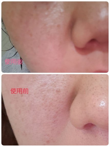 エンリッチプラス 化粧液Ⅱ しっとり <医薬部外品>/ファンケル/化粧水を使ったクチコミ(1枚目)