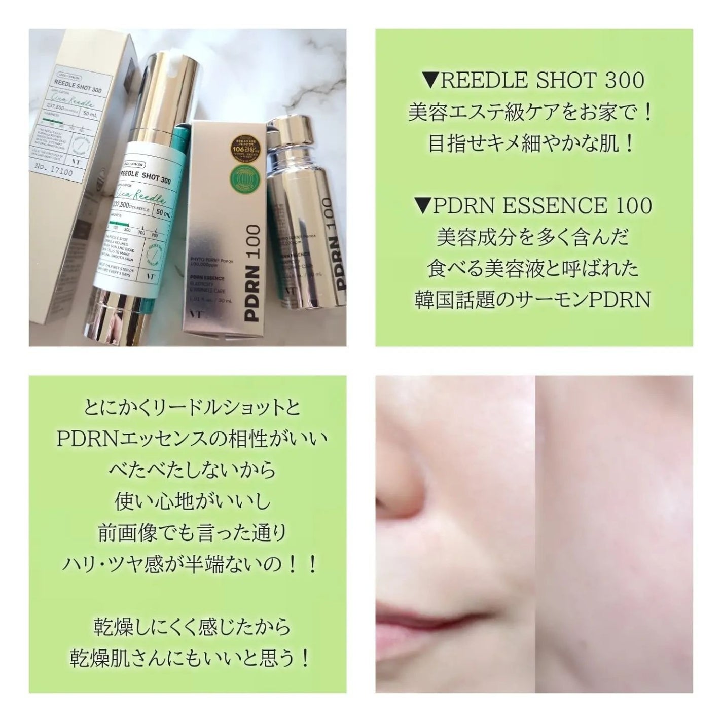 リードルショット300/VT/美容液を使ったクチコミ(3枚目)