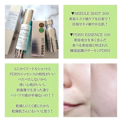 リードルショット300/VT/美容液を使ったクチコミ(3枚目)