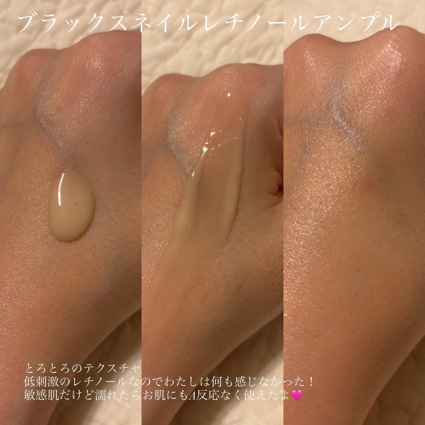 ブラックスネイル クリーム/Dr.G/フェイスクリームを使ったクチコミ(5枚目)