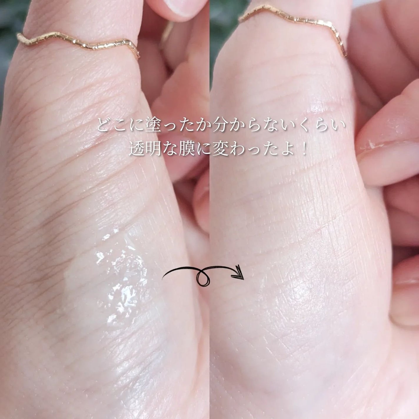 CICA method RECOVER PATCH/コジット/その他スキンケアを使ったクチコミ(5枚目)