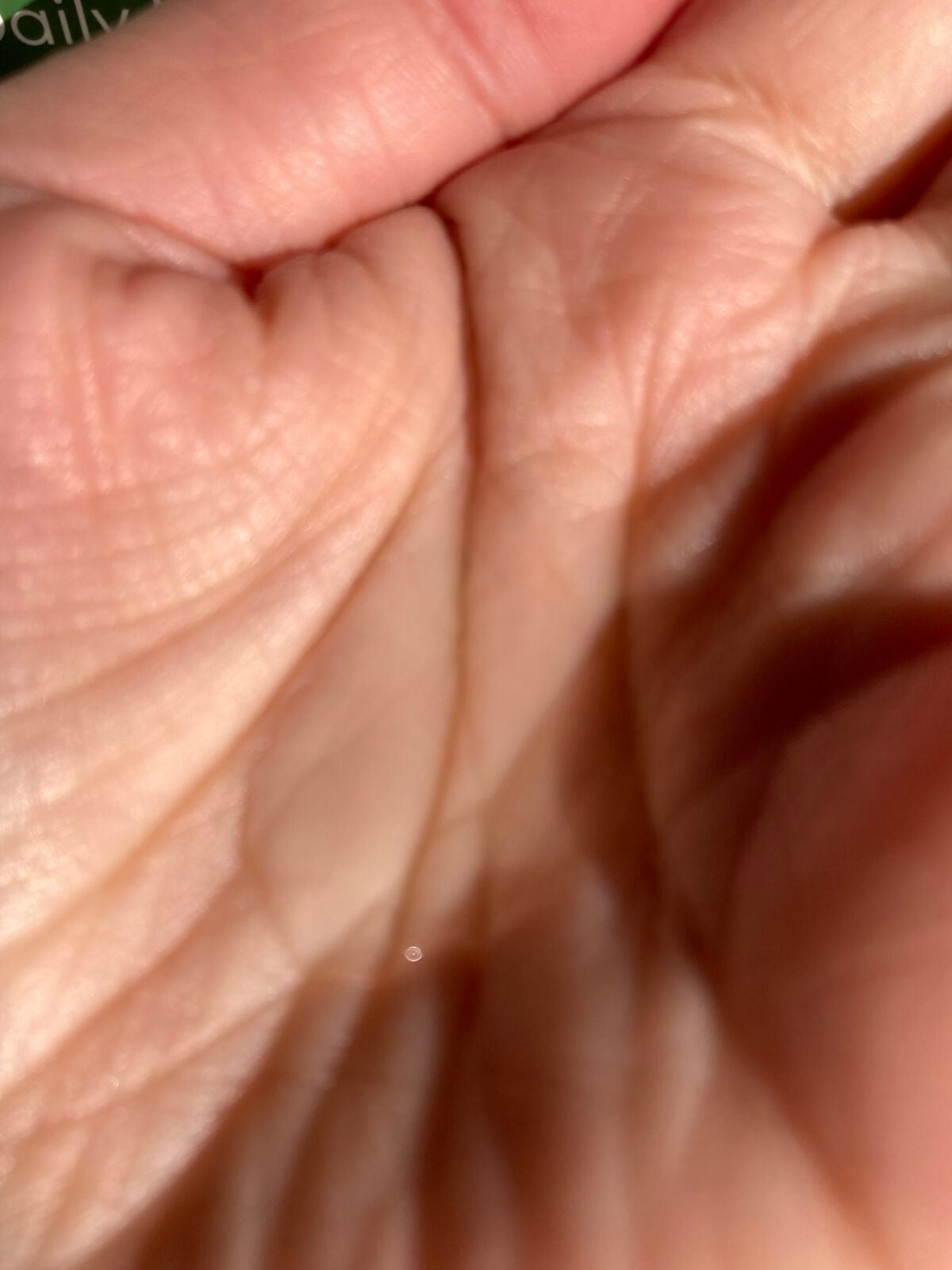 シカ100スージングアンプル/Neulii/美容液を使ったクチコミ(2枚目)