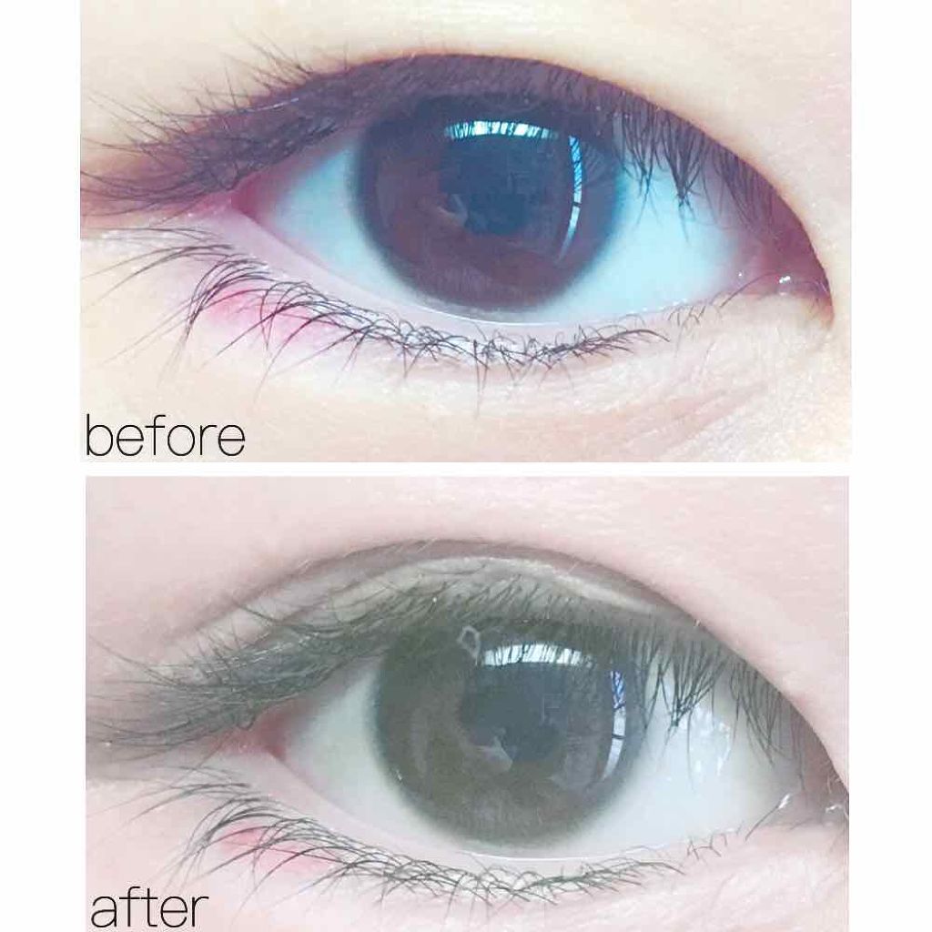 アイトーク/アイトーク/二重まぶた用アイテムを使ったクチコミ（3枚目）