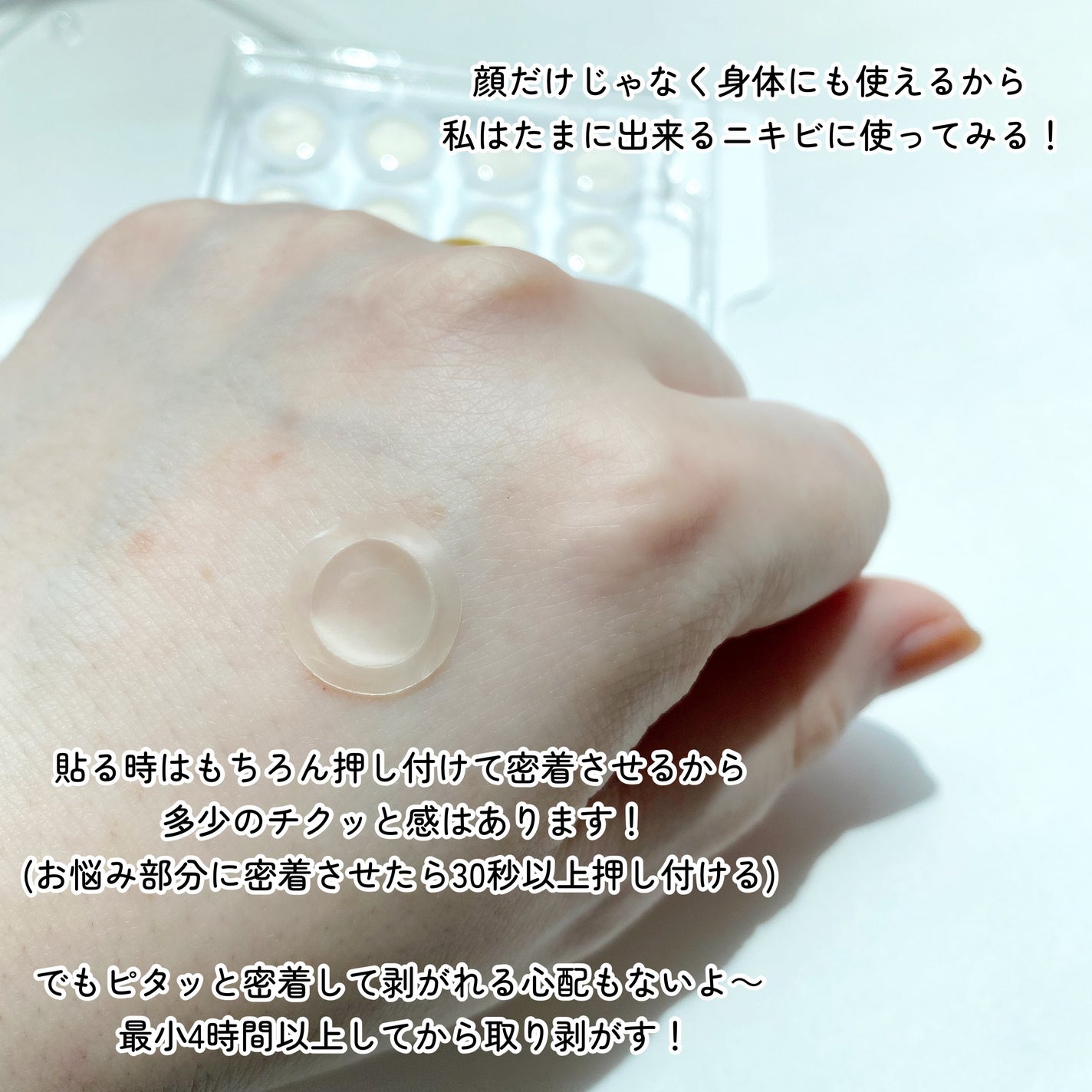 エーキュアショットスポットパッチ/obsero/にきびパッチを使ったクチコミ(7枚目)