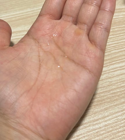ヘパトリート 薬用エイジングケア美容液/ゼトックスタイル/美容液を使ったクチコミ(2枚目)
