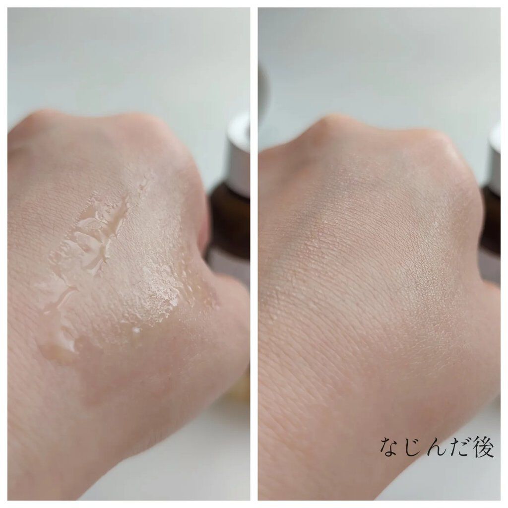 タカミエッセンスCE/タカミ/美容液を使ったクチコミ（2枚目）