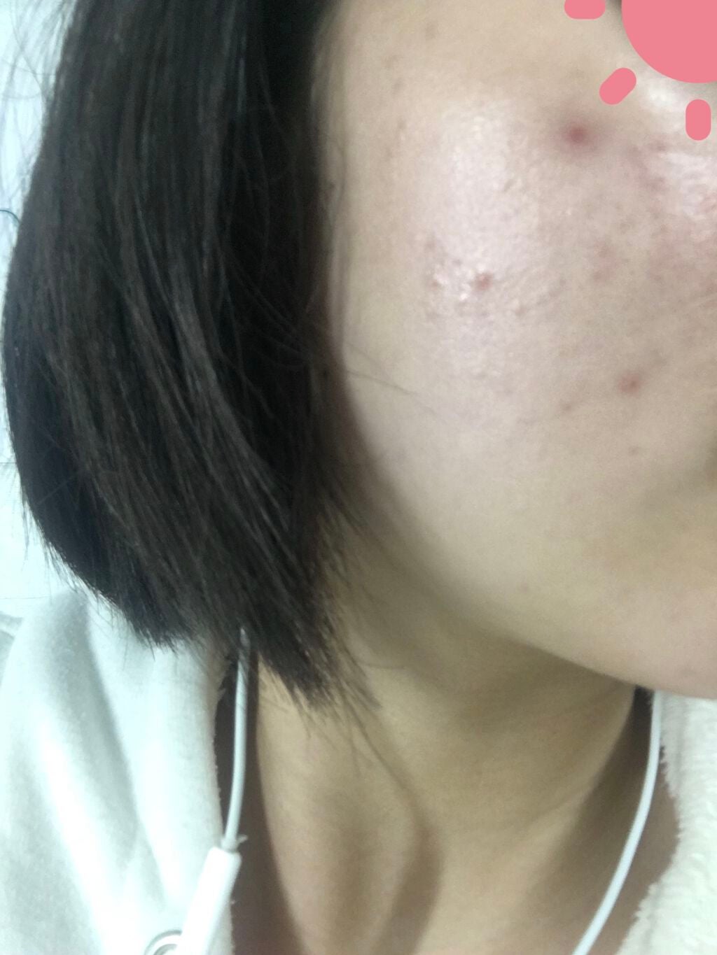 薬用スキンクリーム/オードムーゲ/フェイスクリームを使ったクチコミ(2枚目)