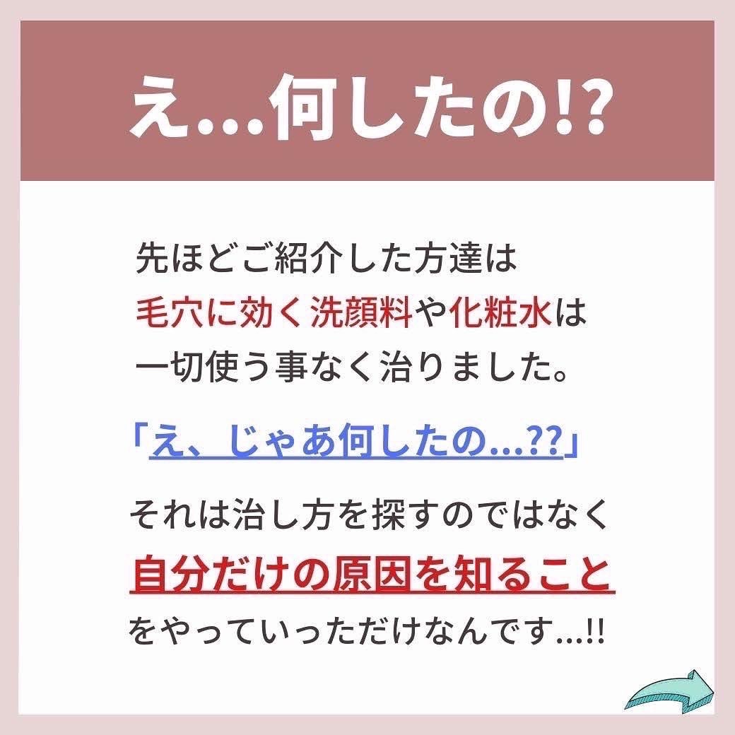 あなたの肌に合ったスキンケア💐コーくん先生 on LIPS 「【驚愕】9割が知らない毛穴を1日で消す方法🤫.
.
.
あなた..」(5枚目)