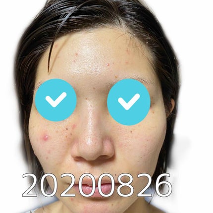 EclatCharme(エクラシャルム)/FABIUS/オールインワン化粧品を使ったクチコミ(1枚目)