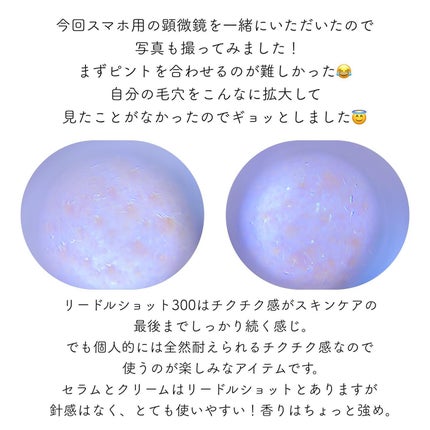 リードルショット300/VT/美容液を使ったクチコミ(5枚目)