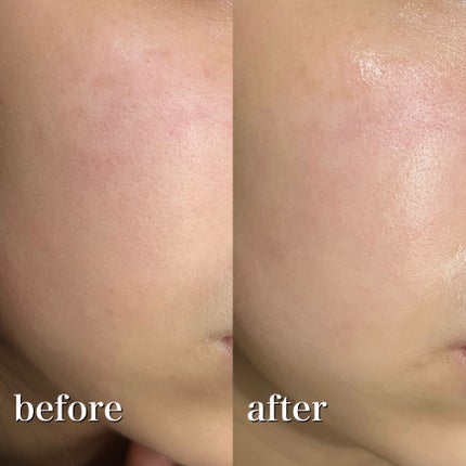 グリーントマトクレイマスククレンザー/FULLY/洗い流すパック・マスクを使ったクチコミ(8枚目)