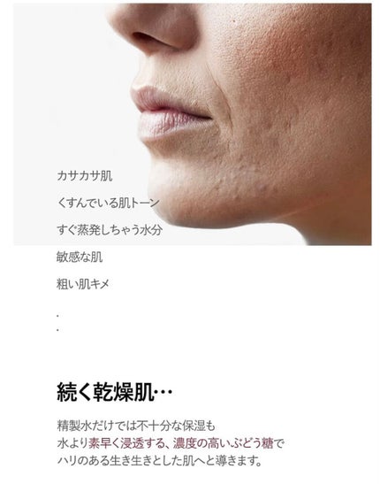 プロP ミスト/CNP Laboratory/ミスト状化粧水を使ったクチコミ(6枚目)