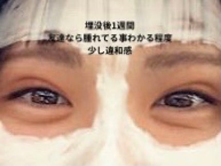 を使ったクチコミ(2枚目)
