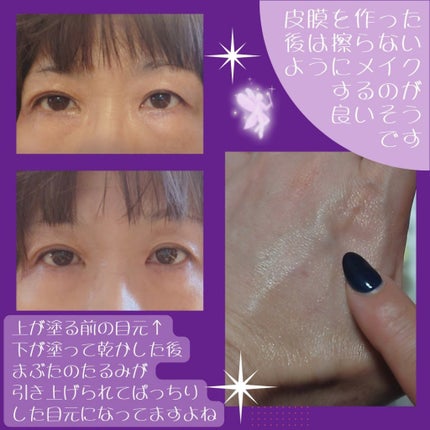 リッドキララ/北の快適工房/アイケア・アイクリームを使ったクチコミ(4枚目)