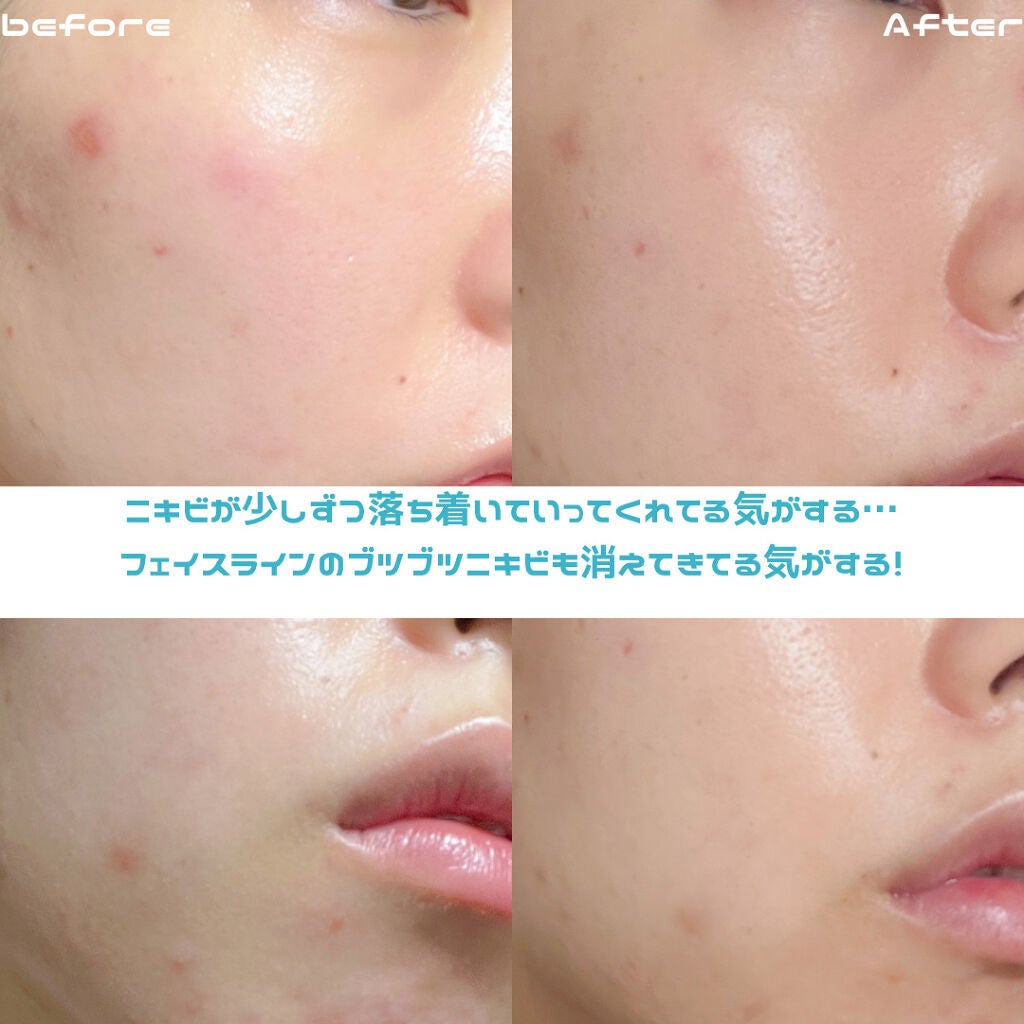 ドクダミ 77 スージングトナー/Anua/化粧水を使ったクチコミ(2枚目)