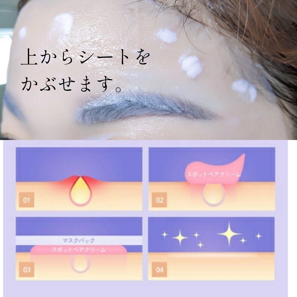 トラブルペアーマスク/DEWYCEL/シートマスク・パックを使ったクチコミ(3枚目)